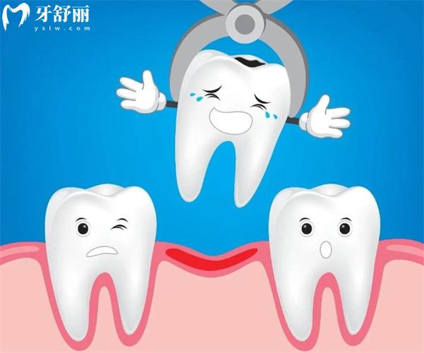 拔牙后十大禁忌你确实不能踩！牙医私藏的避坑指南来了！