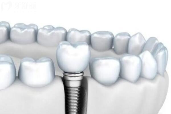 绵阳常乐口腔收费高吗多少钱?2026价格表参考:补牙88元起