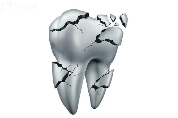 爱嗑瓜子，门牙上磨出了小凹槽，还能**吗？一篇说透不忽悠