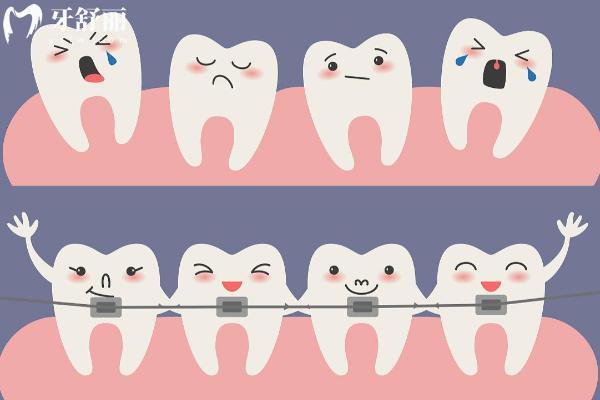 吸附性假牙的利弊