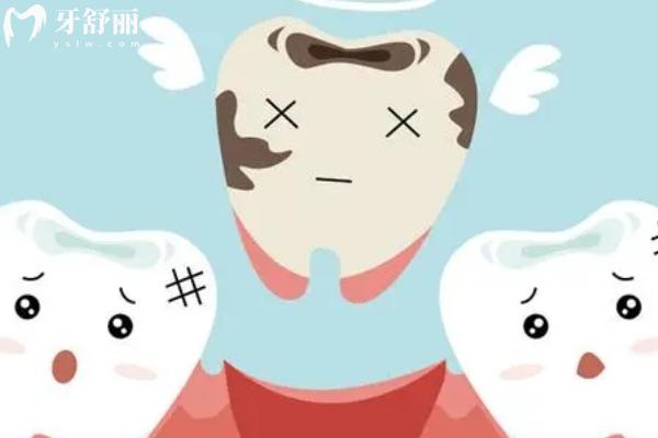 孩子门牙缝太大需要立即矫正吗？可能是在白担心