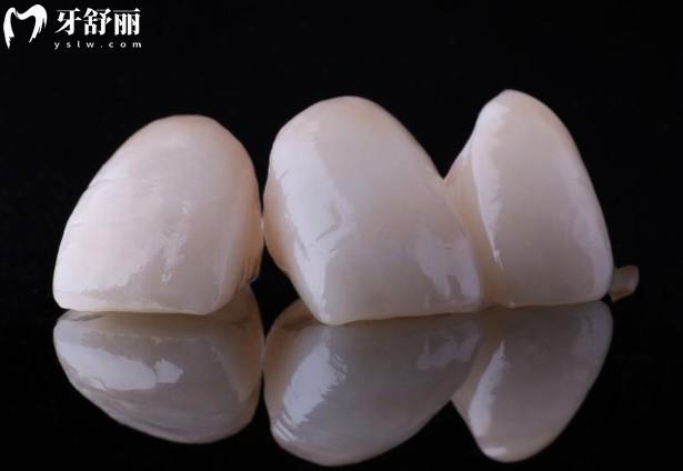 全瓷牙700元和1200元有什么区别? PK:材料/硬度等,看完不踩坑