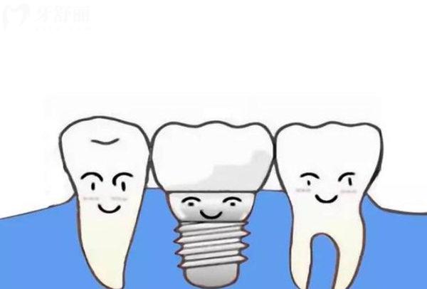  牙槽骨吸收了还能长回来吗?不能,植骨手术帮您解决,看完不慌