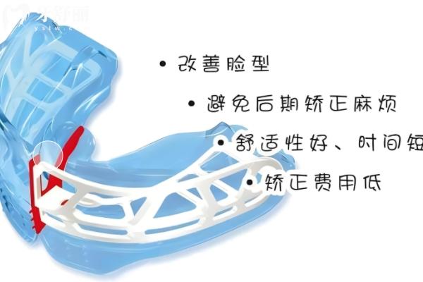 时代天使儿童kid版矫正器咋样