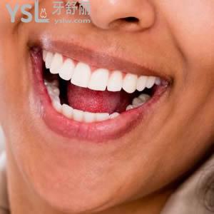 牙齿移动速度过快有什么危害？牙齿矫正的时候需要避免哪几种习惯？