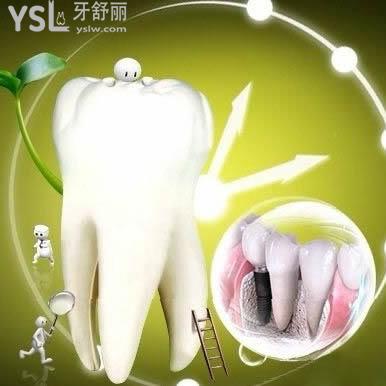 韩国奥齿泰OSSTEM种植牙质量怎么样？广安金典口腔奥齿泰种植体价格为什么比较便宜？