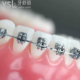 重庆牙科医院前十排名，重庆齐美口腔传统金属正畸价格如何？