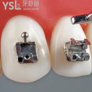 武汉这家比较好的牙科医院已经开门了，牙齿矫正价格好便宜！