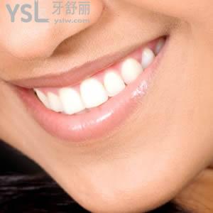 上海永华口腔门诊部收费标准诺贝尔PCC种植牙多少钱？