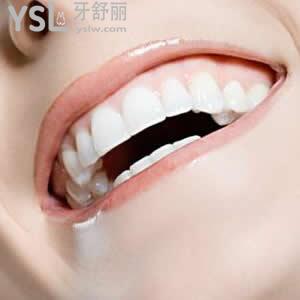 北京圣贝口腔价目表全瓷牙优惠活动来喽！