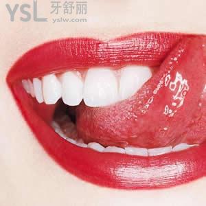 广州圣贝口腔之超声波洁牙价格大概多少钱？
