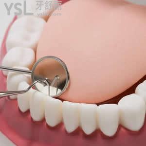 广州圣贝口腔牙齿美白的收费标准是多少？