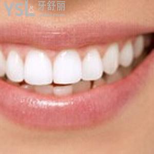 兰州韩美齿科价格表公布，兰州韩美齿科3D锆齿美白价格并不高！