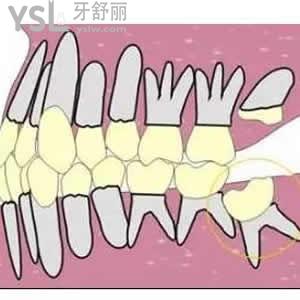 牙科医院和医院口腔科区别？
