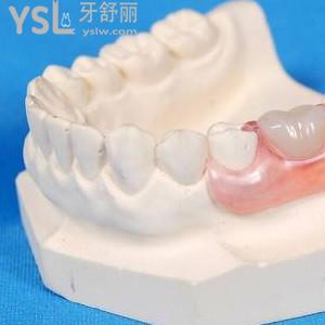 镶牙和种牙有什么区别？