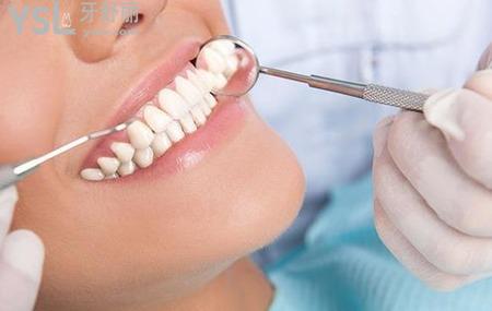 带牙套能改善突嘴吗？