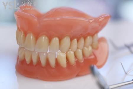 假牙有哪几种？