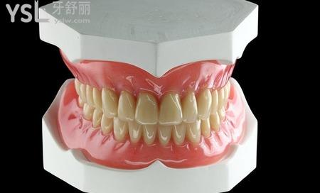 活动义齿修复过程是什么样子的？