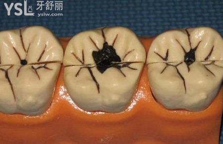 蛀牙的虫子长啥样图片