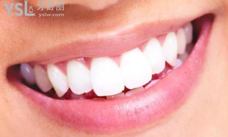 做了美白牙齿牙酸怎么办？