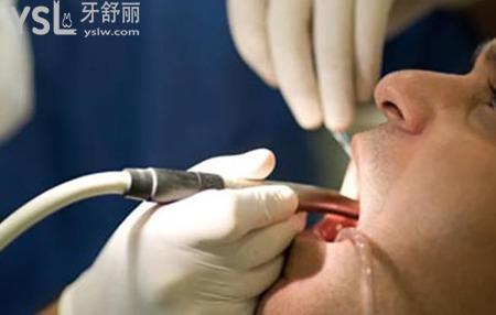 洗牙的过程是怎样的?