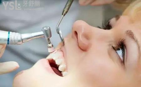 洗牙齿能让牙齿变白吗?