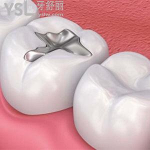 补牙用什么材料最好最牢固？
