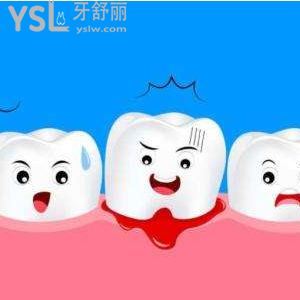 牙周炎和牙龈炎一样吗 怎么区别？