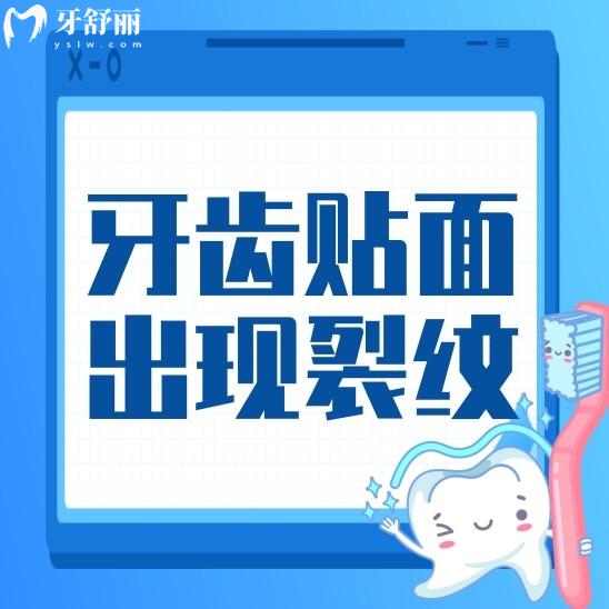突然发现我的牙齿贴面出现了裂纹怎么办呢?谁来救救我