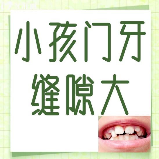 小孩换牙后门牙缝隙太大怎么办?一般都是什么原因引起的