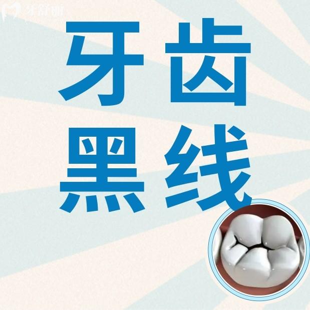 牙齿上的黑线可以刷牙去掉吗?黑线也有多种情况