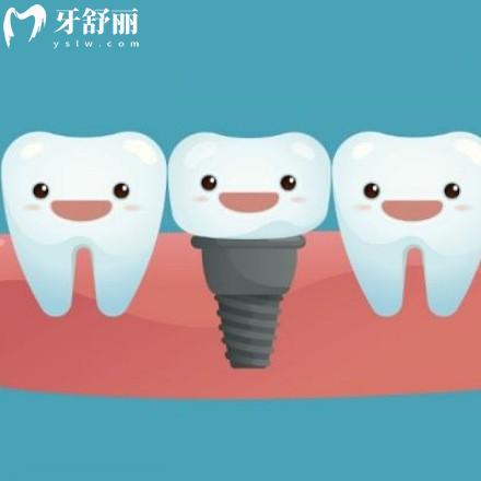 2024新版株洲口腔医院种植牙价格表全,get种植牙比较好的牙科医院多少钱一颗