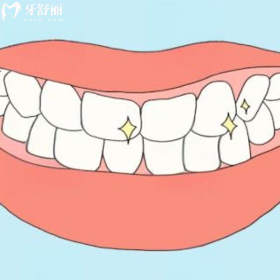30岁做了满口烤瓷牙能用一辈子吗？老了还能用吗？
