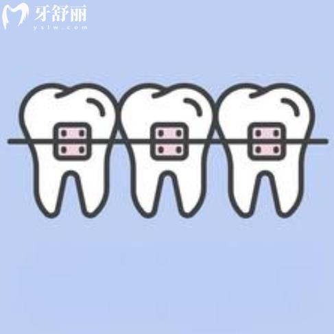 几颗牙齿可以矫正吗？关于局部矫正费用、牙套、周期解读