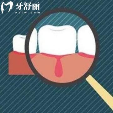 如果缺钙的话牙齿会松动吗?其实是对骨骼的影响从而导致松动