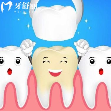做牙冠一般建议选什么样的材料?