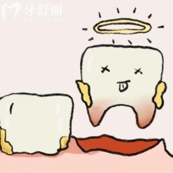 先洗牙还是先拔牙补牙?