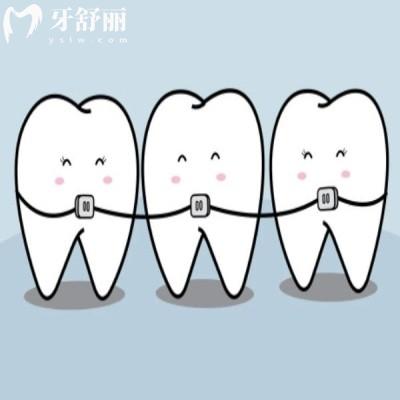洛阳哪里矫正牙齿比较好?上榜五家口腔性价比高值得推荐