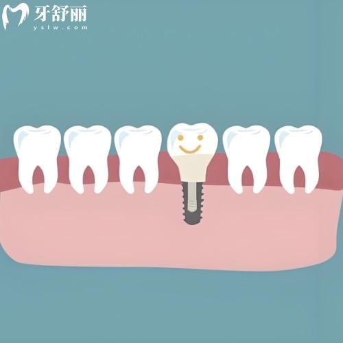 天津口碑好的口腔医院排名:中诺/中幸/海德堡/美奥很靠谱口碑也超好
