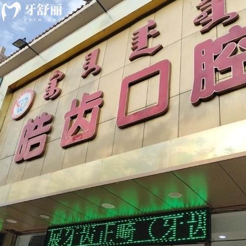乌海皓齿口腔洗一次牙多少钱？80元起还有补牙种牙报价