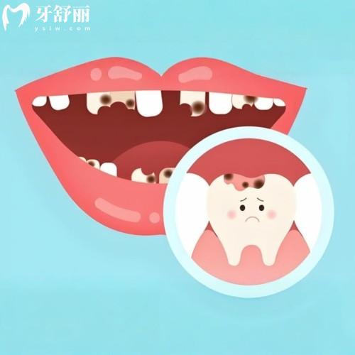 成都私立牙科诊所排名前十:种草几家价格实惠口碑好的牙科机构