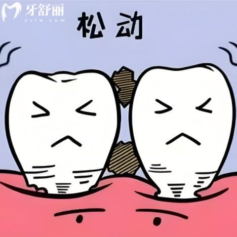 牙齿松动一度二度三度怎么自己区分？教你一眼看懂松牙等级！
