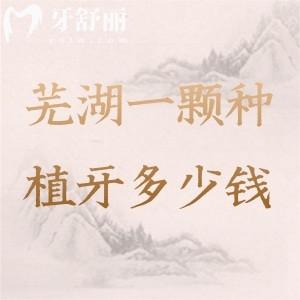 芜湖一颗种植牙多少钱?2025年新版价格表来了!国产/进口/半口/全口植体全都有