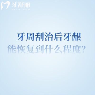 牙周刮治后牙龈能复原到什么程度？复原程度、影响因素、局限性等全揭秘