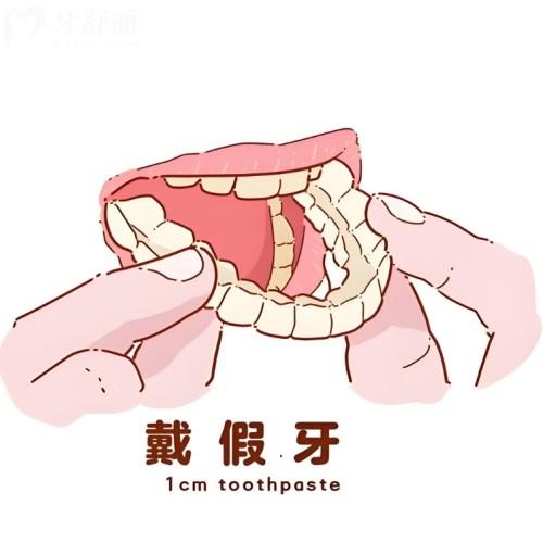 年轻人用什么假牙比较好?年轻人装假牙能吃硬东西吗?这份指南让你吃得香笑得更自信
