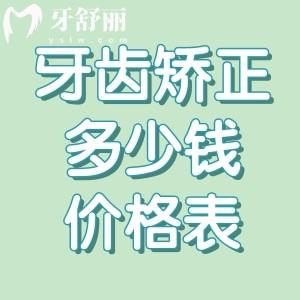牙齿矫正多少钱2025价格表:矫正牙收费价目表详细包含金属/陶瓷/隐形全系列价格