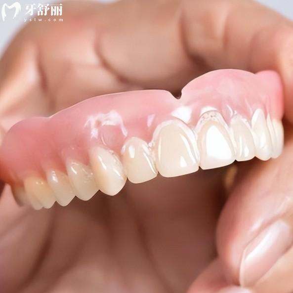 2025活动假牙十大品牌盘点：国产进口品牌优缺点一一解读