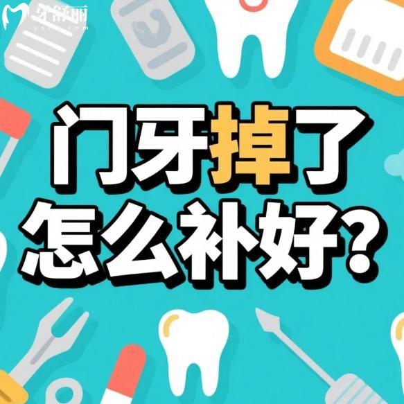 门牙掉了怎么补好?门牙缺失好的修复方法有哪些?门牙掉了怎么办看过便知!