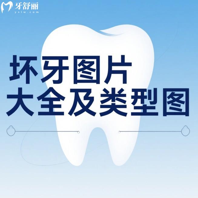 坏牙图片大全及类型图查看:揭秘不同坏牙的发展过程及治疗方案