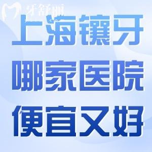 上海镶牙哪家医院便宜又好?分享上海镶假牙技术口碑好的口腔医院及收费标准